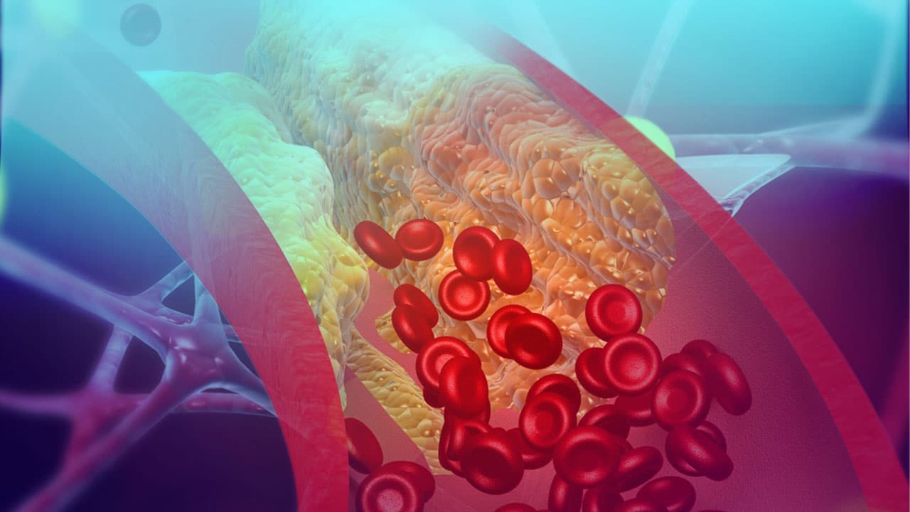 7 Common Signs & Symptoms of Blood Clots Lifestyle Goals